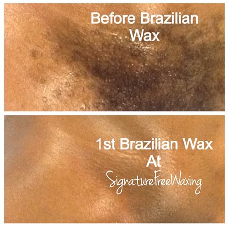 what is a brazilian bikini wax